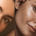 Skin Retouching and Smoothing: An Overview
